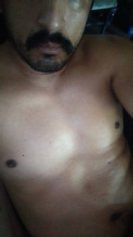 Naxty1