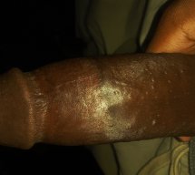 Bbceric18
