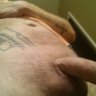 MRICE69
