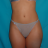Annep